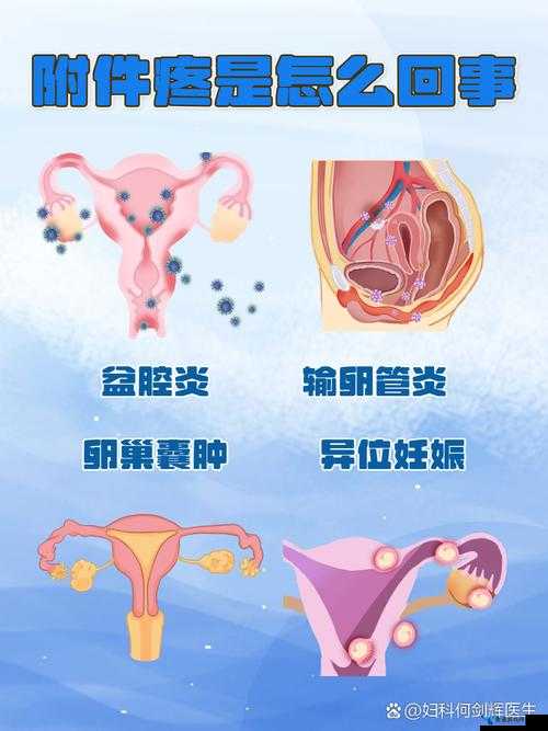 女生下面疼是怎么回事的原因：多种可能性及应对策略